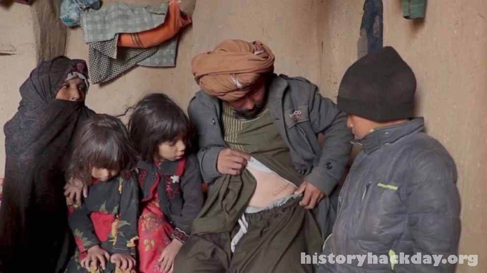 ชาวอัฟกันหลายล้านคนอดอยาก สี่เดือนหลังจากกลุ่มตอลิบานยึดอำนาจ Obaidullah Alikhil พบว่าตัวเองตกงานและดิ้นรนเพื่อหารายได้ในขณะที่ลูกชาย